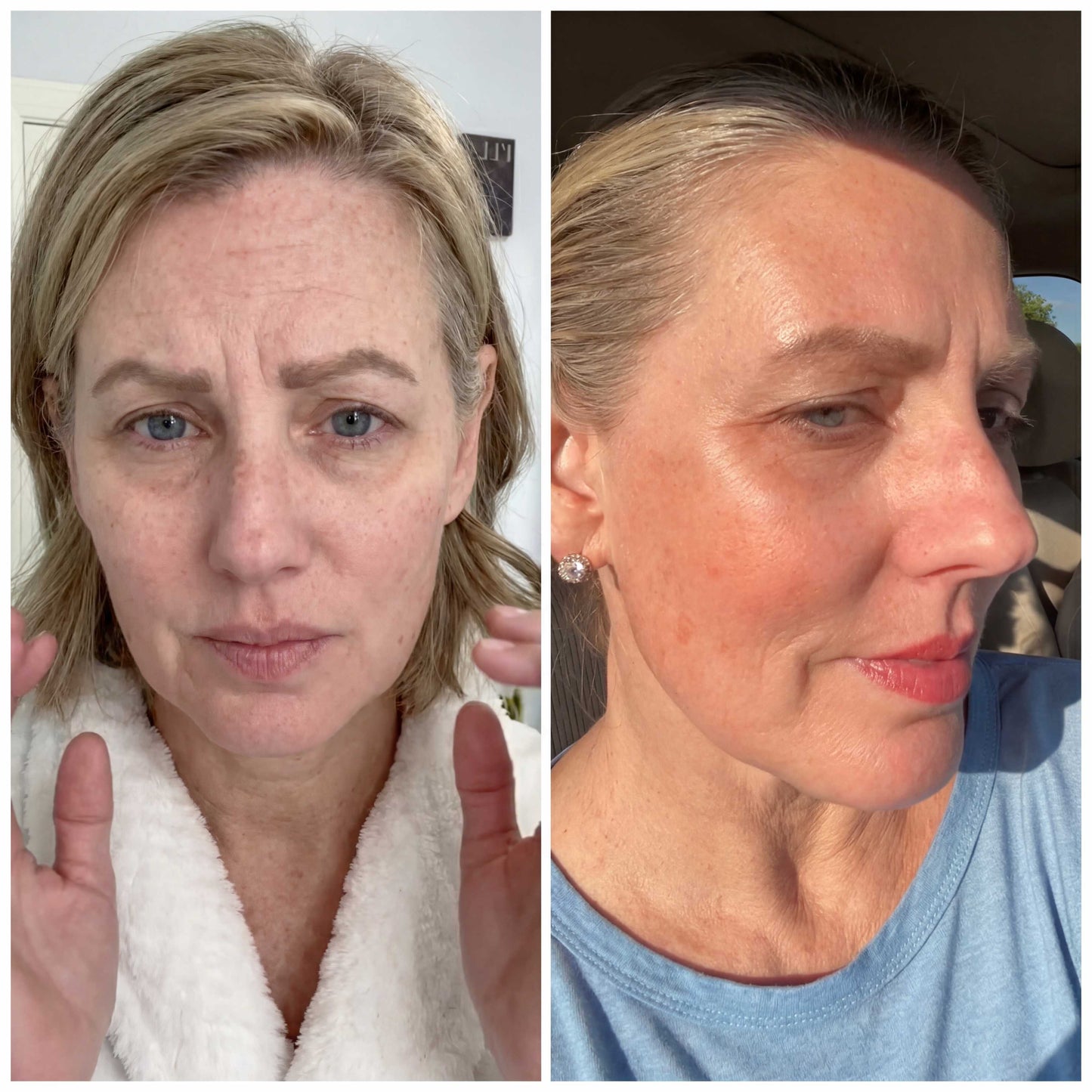 Sculpteur facial à la lumière LED 7 en 1