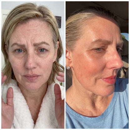 Sculpteur facial à la lumière LED 7 en 1
